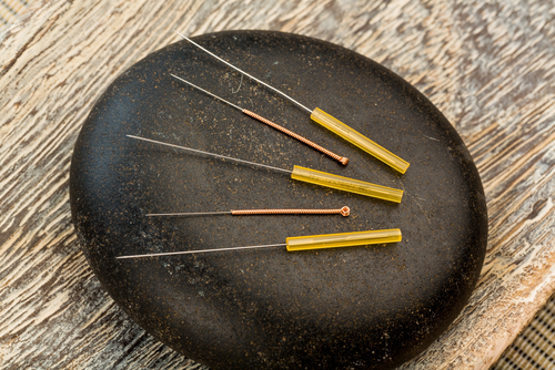 acupuncture